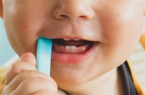 Odontologia infantil