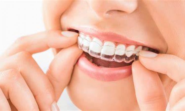 ortodoncia invisible invisalign en esparraguera